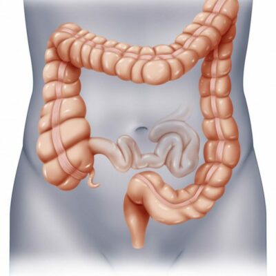 Профилактика рака кишечника — рекомендации нашего специалиста